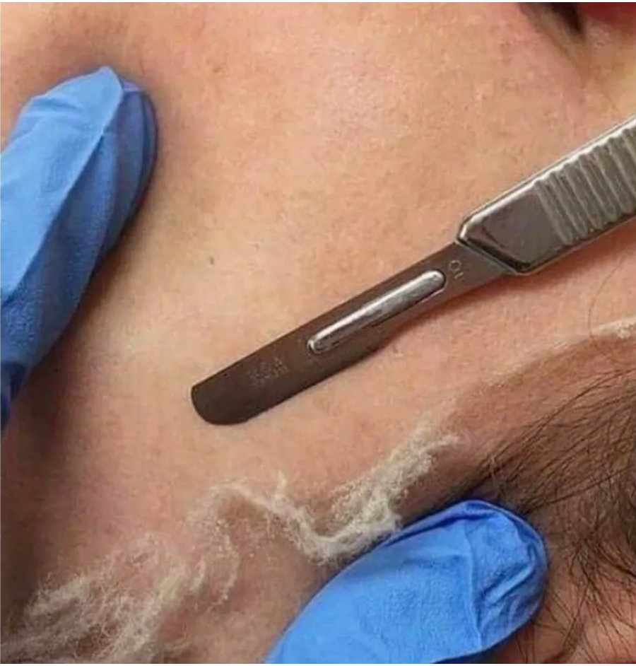 Dermaplane