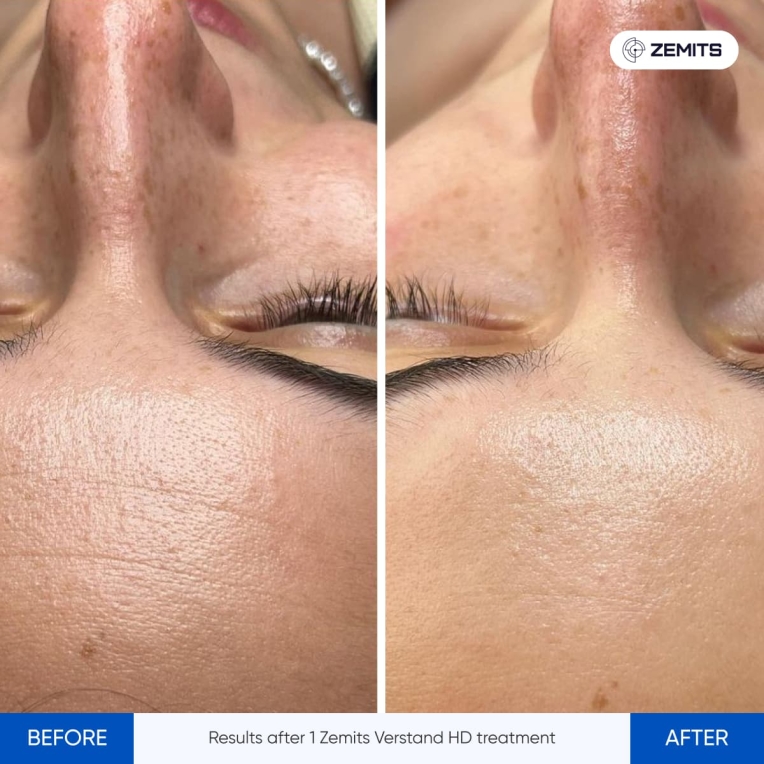 Hydrodiamond before and after-jpg