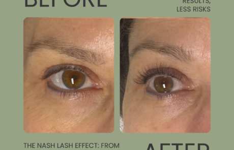 Beige Minimalist Beauty Skincare Before After Collage Instagram Post